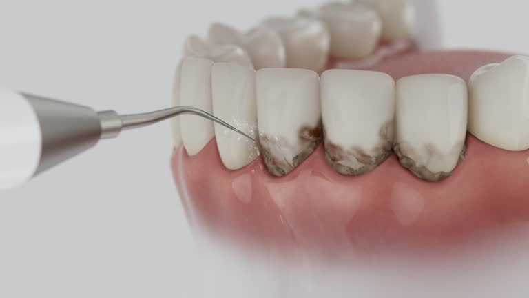 Trusted Dental Crowns And Bridges service in Louisa, KY - Dentist Open Now
